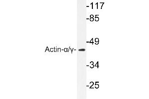 Image no. 2 for anti-Actin (pan) antibody (ABIN271986) (Actin anticorps  (pan))