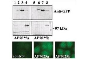 Upper panel, western blot analysis of GFP fusion protein expression in Panc-1 cells by using an anti-GFP antibody. (PRKD3 anticorps  (C-Term))