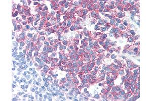 Anti-PAG1 / PAG antibody IHC of human tonsil. (PAG1 anticorps  (C-Term))