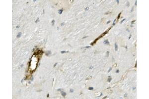 IHC analysis of MSN using anti-MSN antibody (ABIN7600378). (Moesin anticorps  (AA 184-568))