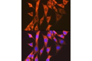 Immunofluorescence analysis of NIH-3T3 cells using eEF2 Rabbit mAb (ABIN7267025) at dilution of 1:100 (40x lens).