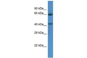 Host:  Rabbit  Target Name:  TMC7  Sample Type:  HCT15 Whole Cell lysates  Antibody Dilution:  1. (TMC7 anticorps  (N-Term))