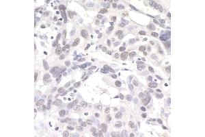 Immunohistochemistry (IHC) image for anti-DNA Kinase/phosphatase Pnk1 (PNK1) (AA 100-150) antibody (ABIN7454516) (Pnk1 anticorps  (AA 100-150))