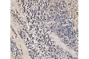 IHC analysis of HMGCS2 using anti-HMGCS2 antibody (ABIN7599435). (HMGCS2 anticorps  (AA 1-487))