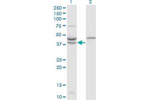 Western Blot analysis of UPB1 expression in transfected 293T cell line by UPB1 monoclonal antibody (M09), clone 3F12.