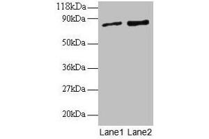 Western blot All lanes: RAB1A antibody at 2 μg/mL Lane 1: EC109 whole cell lysate Lane 2: 293T whole cell lysate Secondary Goat polyclonal to rabbit IgG at 1/15000 dilution Predicted band size: 23, 16, 14 kDa Observed band size: 80 kDa (RAB1A anticorps  (AA 2-205))