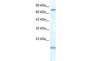 Western Blotting (WB) image for anti-PiggyBac Transposable Element Derived 3 (PGBD3) antibody (ABIN2461365) (PGBD3 anticorps)
