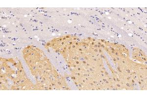 Detection of BDNF in Rat Cerebrum Tissue using Polyclonal Antibody to Brain Derived Neurotrophic Factor (BDNF) (BDNF anticorps  (AA 20-252))