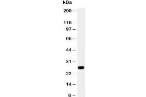 Western blot testing of Aquaporin 8 antibody and A431 cell lysate. (Aquaporin 8 anticorps  (N-Term))