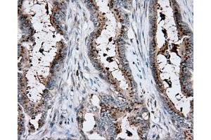 Immunohistochemical staining of paraffin-embedded pancreas tissue using anti-RC200180 mouse monoclonal antibody.