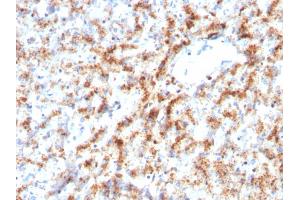 Formalin-fixed, paraffin-embedded human Liver stained with Cathepsin D Mouse Monoclonal Antibody (CTSD/3082). (Cathepsin D anticorps  (AA 104-250))