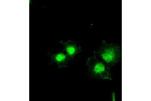 Anti-BCL2L1 mouse monoclonal antibody (ABIN2452380) immunofluorescent staining of COS7 cells transiently transfected by pCMV6-ENTRY BCL2L1 (RC201314). (BCL2L1 anticorps  (AA 1-212))