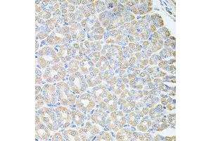 Immunohistochemistry of paraffin-embedded mouse stomach using SKAP2 antibody at dilution of 1:100 (x40 lens).