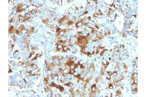 Formalin-fixed, paraffin-embedded human adrenal gland stained with Chromogranin A antibody (CHGA/765)