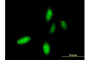 Immunofluorescence of monoclonal antibody to HOXC10 on HeLa cell. (HOXC10 anticorps  (AA 158-257))