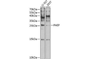 Western blot analysis of extracts of various cell lines, using PAEP antibody (ABIN6130606, ABIN6145168, ABIN6145170 and ABIN6221423) at 1:1000 dilution. (PAEP anticorps  (AA 19-180))