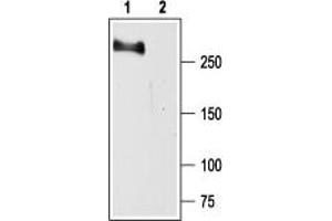 Western blot analysis of rat brain membranes: - 1.