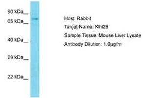 Image no. 1 for anti-Kelch-Like 26 (KLHL26) (AA 51-100) antibody (ABIN6750241) (KLHL26 anticorps  (AA 51-100))