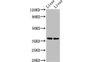Western Blot Positive WB detected in: Mouse liver tissue, Rat liver tissue All lanes: CCNH antibody at 3 μg/mL Secondary Goat polyclonal to rabbit IgG at 1/50000 dilution Predicted band size: 38 kDa Observed band size: 38 kDa (Cyclin H anticorps  (AA 261-319))