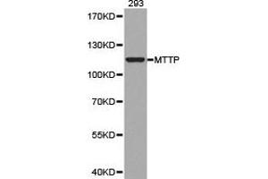 Western blot analysis of extracts of 293 cell lines, using MTTP antibody. (MTTP anticorps)