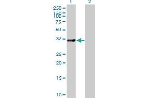 Western Blot analysis of LMOD1 expression in transfected 293T cell line by LMOD1 MaxPab polyclonal antibody. (Leiomodin 1 anticorps  (AA 1-269))
