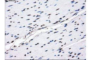 Immunohistochemical staining of paraffin-embedded endometrium tissue using anti-GBE1mouse monoclonal antibody.