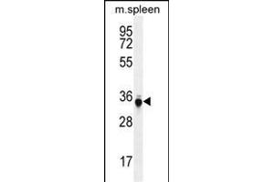 TP53INP1 Antibody (C-term) (ABIN655833 and ABIN2845249) western blot analysis in mouse spleen tissue lysates (35 μg/lane). (TP53INP1 anticorps  (C-Term))
