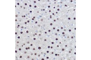 Immunohistochemistry of paraffin-embedded rat liver using EZH2/KMT6 Rabbit pAb (ABIN6133511, ABIN6140395, ABIN6140399 and ABIN6221414) at dilution of 1:100 (40x lens). (EZH2 anticorps  (AA 1-250))