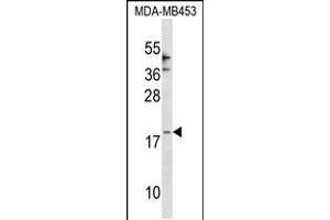 Western blot analysis in MDA-MB453 cell line lysates (35ug/lane). (CCL25 anticorps  (AA 66-95))