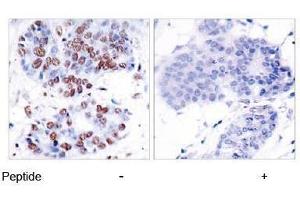 Image no. 1 for anti-Nuclear Factor-kB p65 (NFkBP65) (Ser276) antibody (ABIN197110) (NF-kB p65 anticorps  (Ser276))