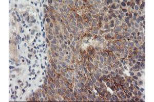 Image no. 5 for anti-Metalloproteinase Inhibitor 2 (TIMP2) antibody (ABIN1501394) (TIMP2 anticorps)