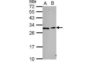 WB Image Sample (30 ug of whole cell lysate) A: NT2D1 B: SK-N-SH 12% SDS PAGE antibody diluted at 1:1000 (TATDN3 anticorps  (Center))