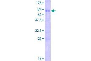 Image no. 1 for Small Nuclear Ribonucleoprotein 48kDa (U11/U12) (SNRNP48) (AA 1-339) protein (GST tag) (ABIN1320820)