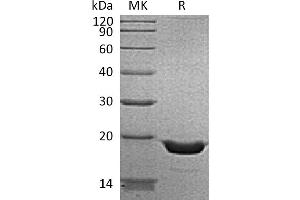 Greater than 95 % as determined by reducing SDS-PAGE.