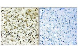 Immunohistochemistry (IHC) image for anti-CTD (Carboxy-terminal Domain, RNA Polymerase II, Polypeptide A) Small Phosphatase 1 (CTDSP1) (N-Term) antibody (ABIN1851030)