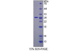 SDS-PAGE analysis of Human VARS Protein. (VARS Protéine)