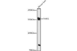 Western blot analysis of extracts of Mouse liver, using THBS1 antibody (ABIN3022978, ABIN3022979, ABIN3022980 and ABIN6219329) at 1:500 dilution.