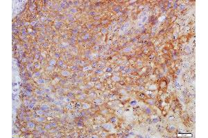 Formalin-fixed and paraffin embedded human endometrium labeled with Anti-FSH/FSHB Polyclonal Antibody, Unconjugated  at 1:200 followed by conjugation to the secondary antibody and DAB staining (FSHB anticorps  (AA 61-98))
