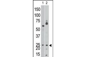 Antibody is used in Western blot to detect NIP3 BH3 in Ramos cell lysate (lane 1) and in mouse brain tissue lysate (lane 2). (BNIP3 anticorps  (AA 152-187))