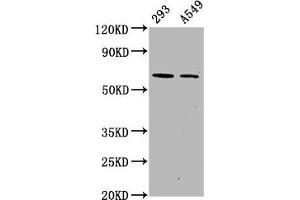 Western Blot Positive WB detected in 293 whole cell lysate 65549 whole cell lysate All lanes Phospho-PRKAA2 antibody at 1. (Recombinant PRKAA2 anticorps  (pSer491))