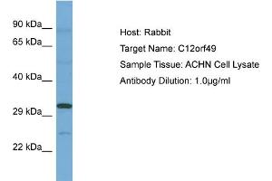 Host: Rabbit Target Name: C12ORF49 Sample Tissue: Human ACHN Whole Cell Antibody Dilution: 1ug/ml (C12orf49 anticorps  (N-Term))