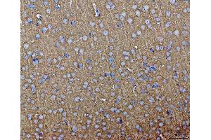 IHC analysis of Septin 3/SEPTIN3 using anti-Septin 3/SEPTIN3 antibody (ABIN7599288). (Septin 3 anticorps  (AA 1-339))