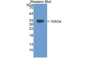 Detection of Recombinant Pax, Human using Polyclonal Antibody to Paxillin (PXN) (Paxillin anticorps  (AA 201-461))