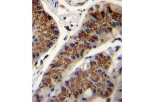 INHBA Antibody (N-term) (ABIN655078 and ABIN2844710) immunohistochemistry analysis in formalin fixed and paraffin embedded human stomach tissue followed by peroxidase conjugation of the secondary antibody and DAB staining.