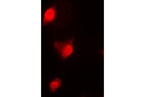 Immunofluorescent analysis of Cyclin B1 staining in K562 cells. (Cyclin B1 anticorps  (Center))