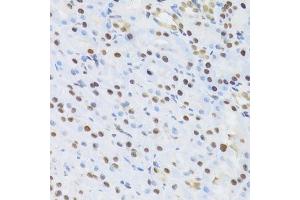 Immunohistochemistry of paraffin-embedded rat kidney using SFN Antibody. (14-3-3 sigma/SFN anticorps  (AA 1-248))