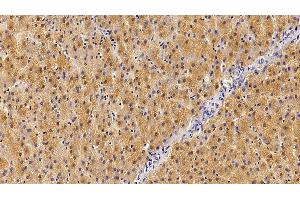 Detection of GHR in Human Liver Tissue using Polyclonal Antibody to Growth Hormone Receptor (GHR) (Growth Hormone Receptor anticorps  (AA 315-574))