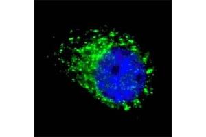 Fluorescent image of chloroquine treated U251 cells stained with MAP1LC3A antibody (1:100). (MAP1LC3A anticorps  (AA 100-125))