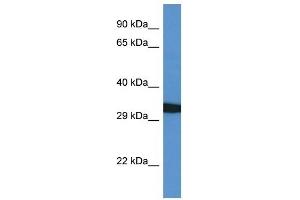 Western Blot showing GFRA4 antibody used at a concentration of 1 ug/ml against 721_B Cell Lysate (GFRA4 anticorps  (C-Term))