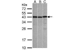 WB Image Sample(30 ug whole cell lysate) A:A431, B:Hep G2 , C:Raji , 12% SDS PAGE antibody diluted at 1:1000 (ZC3H8 anticorps)